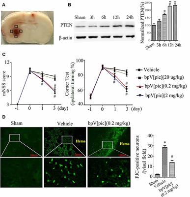 PTEN Inhibition Protects Against Experimental Intracerebral Hemorrhage-Induced Brain Injury Through PTEN/E2F1/β-Catenin Pathway